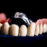 Dentallabor Wohlfart Herkel GmbH